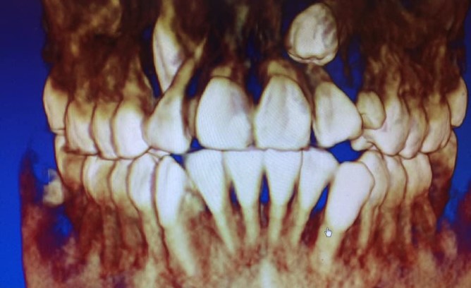 CBCT1