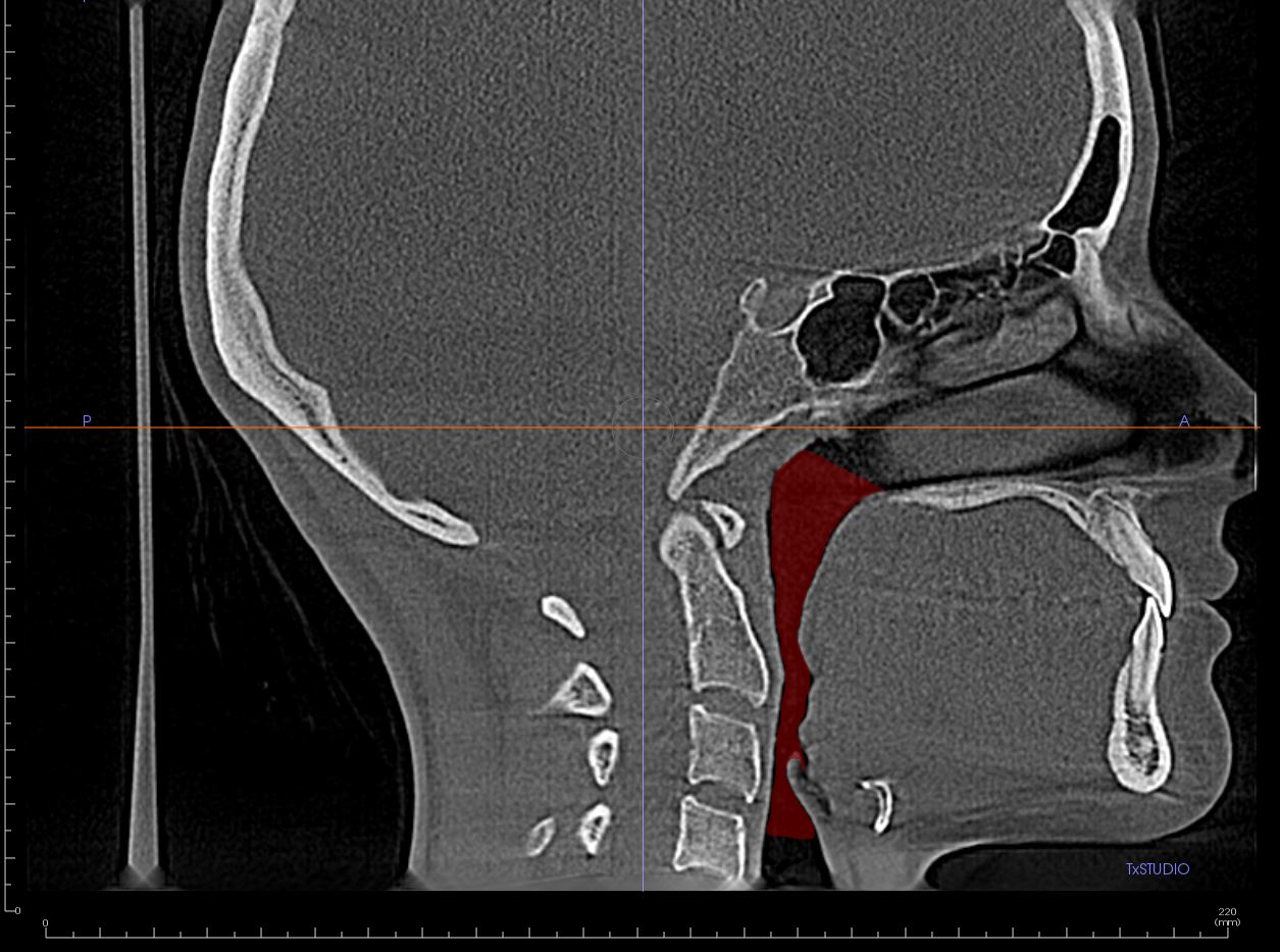 CBCT2
